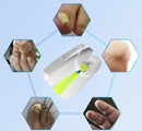 Portable Fungus Nail Laser