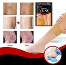 Varicose Veins Treatment Patch