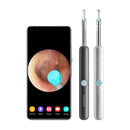 Smart Visual Ear Cleaner Endoscope, Earwax Remover Tool, for iOS Android