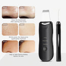 Ultrasonic Skin Scrubber Skin Beauty Device